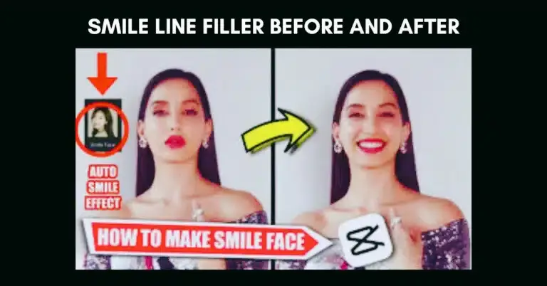 Smile Line Filler Before and After in CapCut